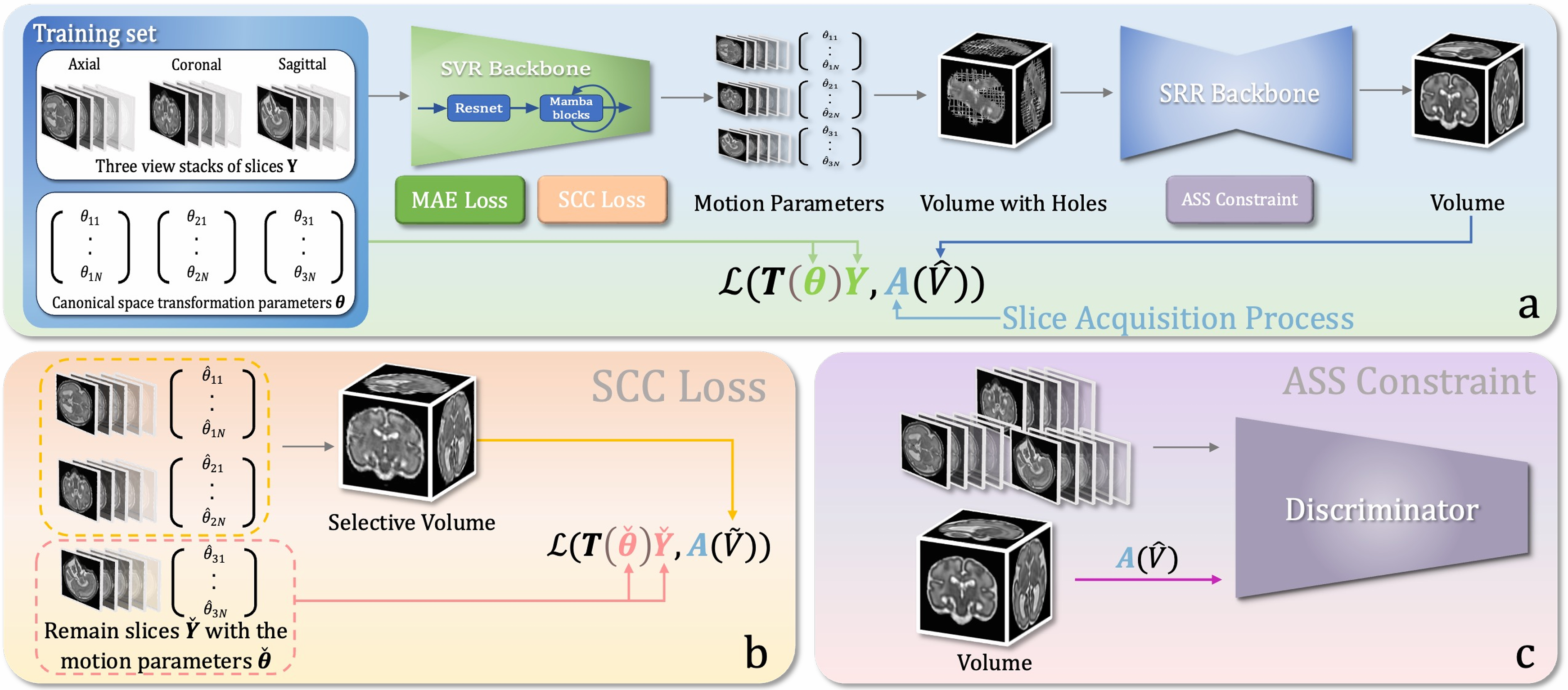 SAFFRON: A Physics-informed, Label-free Self-supervised Deep Learning Framework for Fast and Accurate 3D Fetal Brain MRI Reconstruction