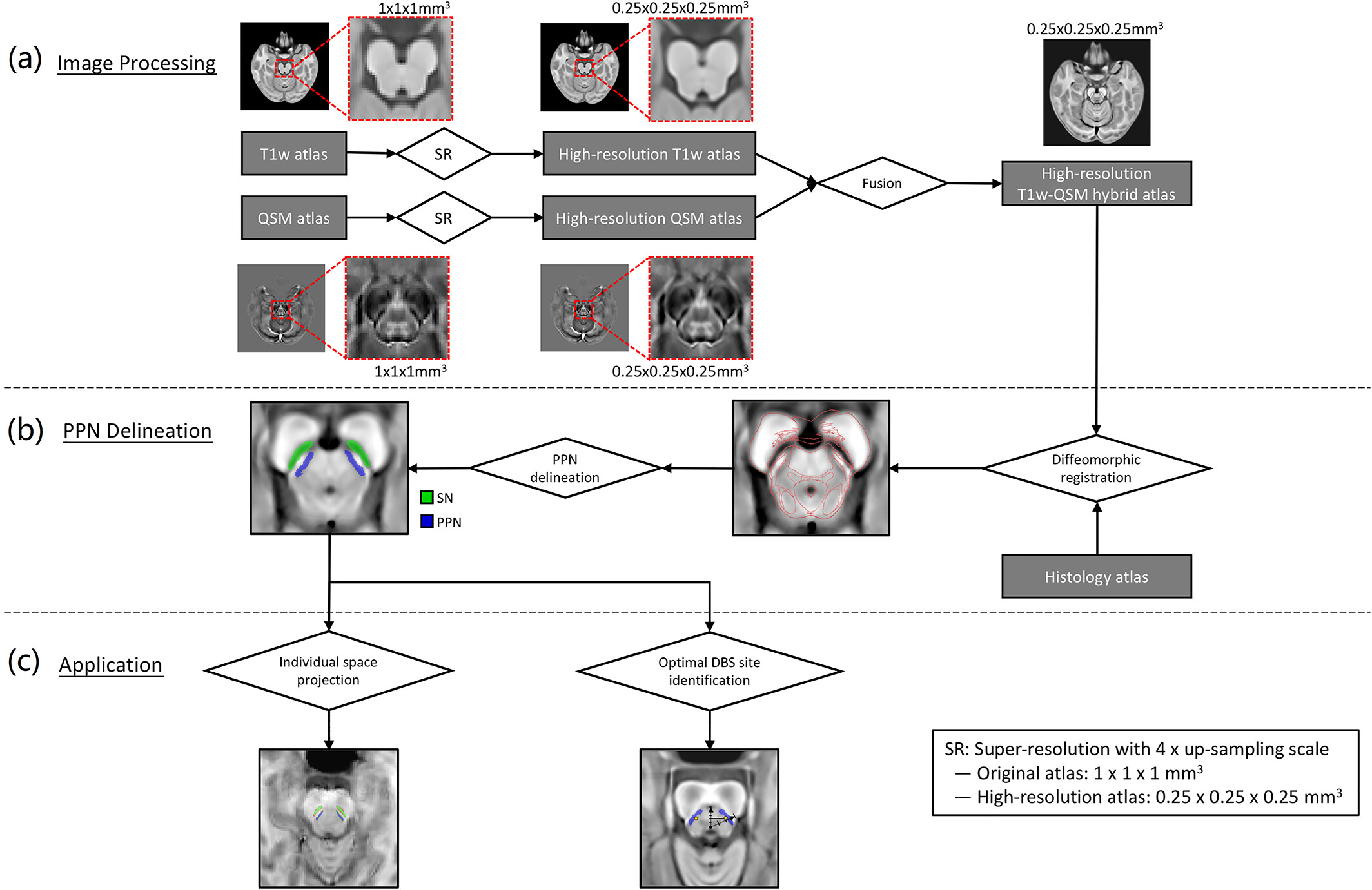 Direct localization and delineation of human pedunculopontine nucleus based on a self-supervised magnetic resonance image super-resolution method